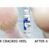 Jalgade vahtkreem Footlogix 3+ Extra Cracked Heel Formula 125ml - Image 2